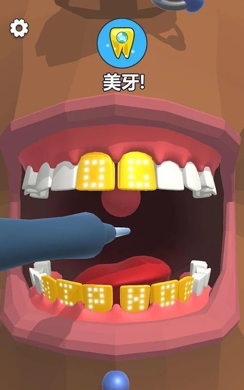 拔牙游戏攻略 VS cago游戏攻略